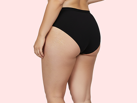 La Suzanne - photo 2